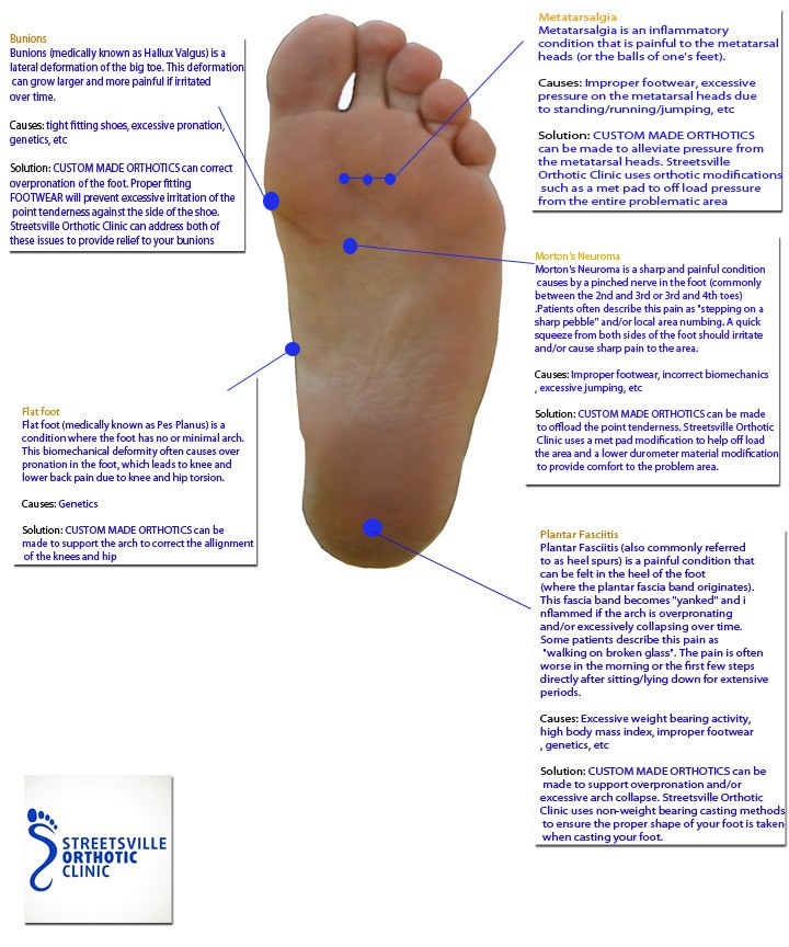 Common Conditions – Streetsville Orthotic Clinic